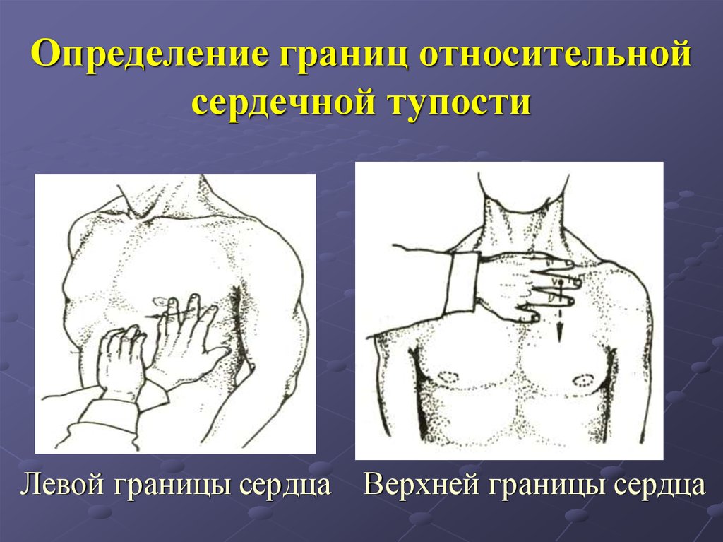 Определить границы. Относительная граница сердца перкуссия. Перкуссия сердца Относительная тупость сердца. Границы относительной тупости сердца перкуссия. Левая граница сердца перкуссия.