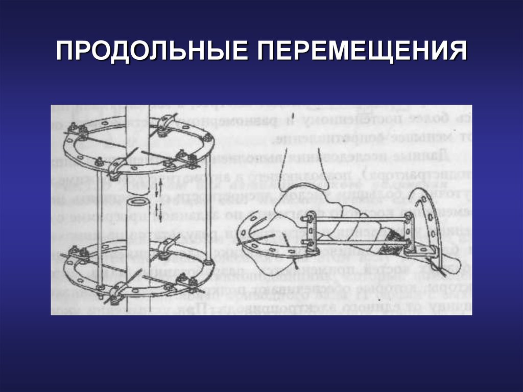 Поперечное направление. Продольное перемещение. Продольное и поперечное перемещение. Продольно поперечные движения. Механизм поперечно продольного перемещения.