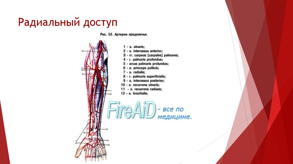 Радиальный доступ