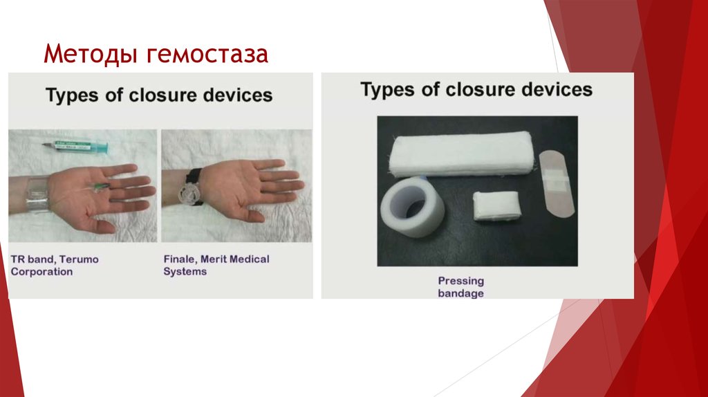 Методы гемостаза
