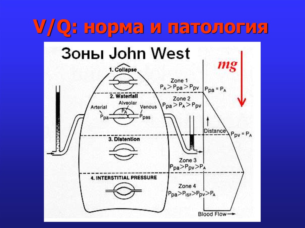 V/Q: норма и патология
