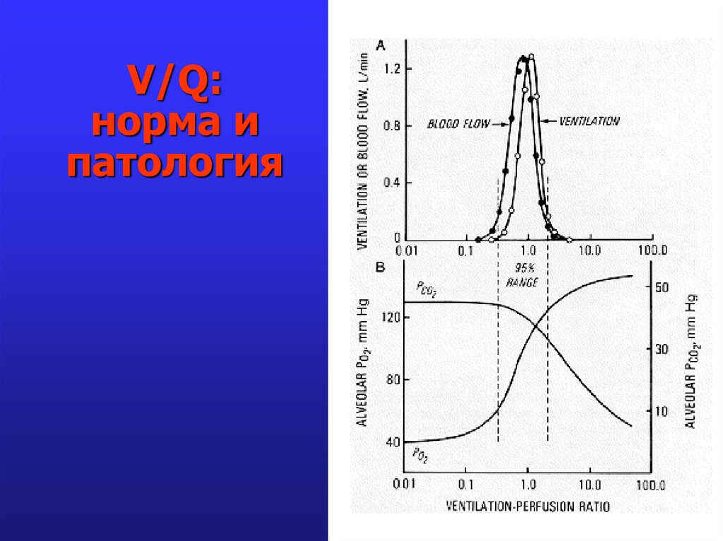 V/Q: норма и патология