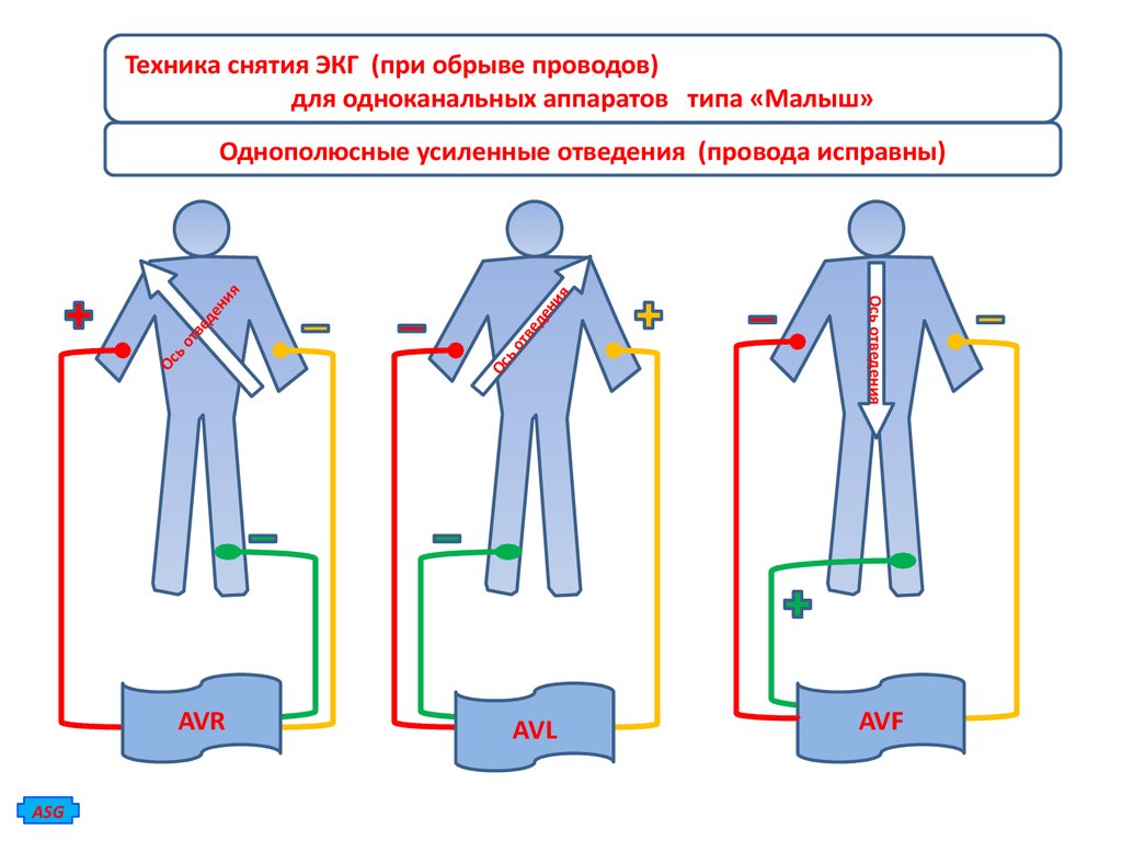 Методика снятия экг. Техника снятия ЭКГ. Оборудование для снятия ЭКГ. Техника безопасности при снятии ЭКГ.