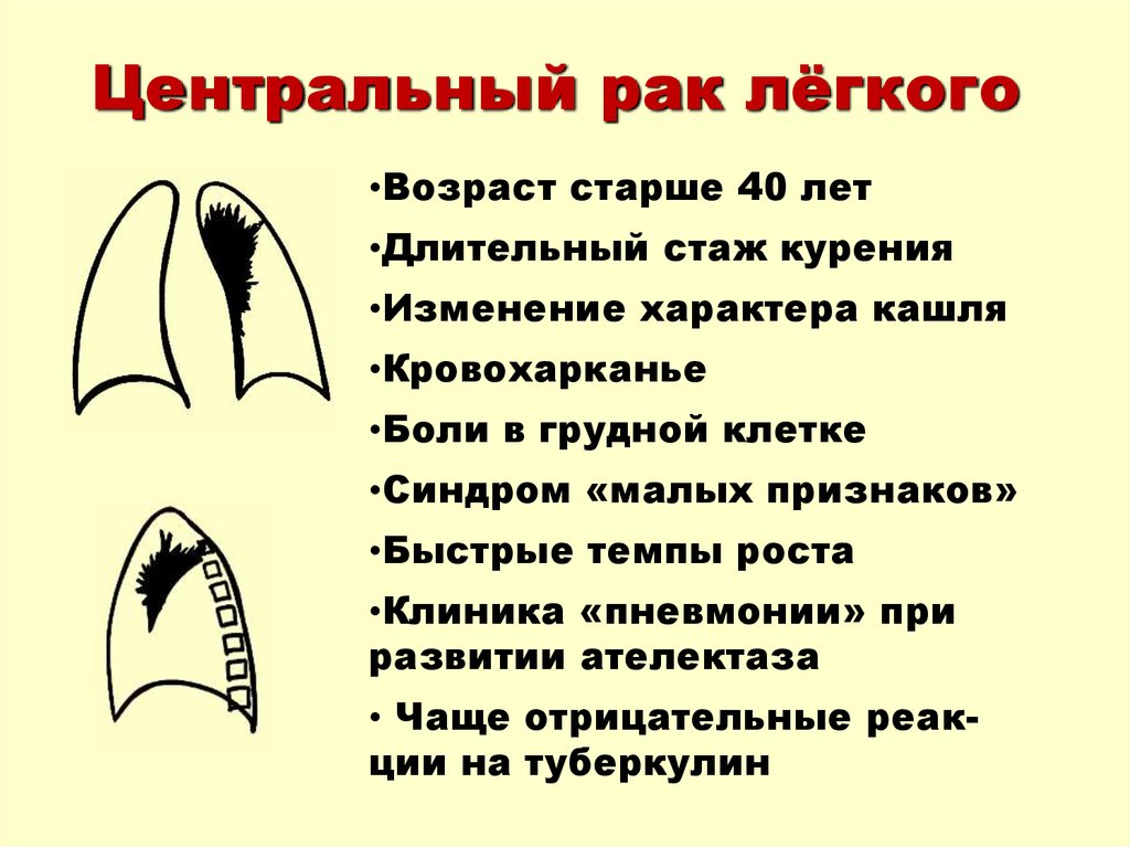 Диффузный рак легких что это. Обструктивные и деструктивные заболевания легких. Доброкачественные опухоли легких. Периферическая опухоль верхней доли правого легкого. Диффузный рак легких что это.