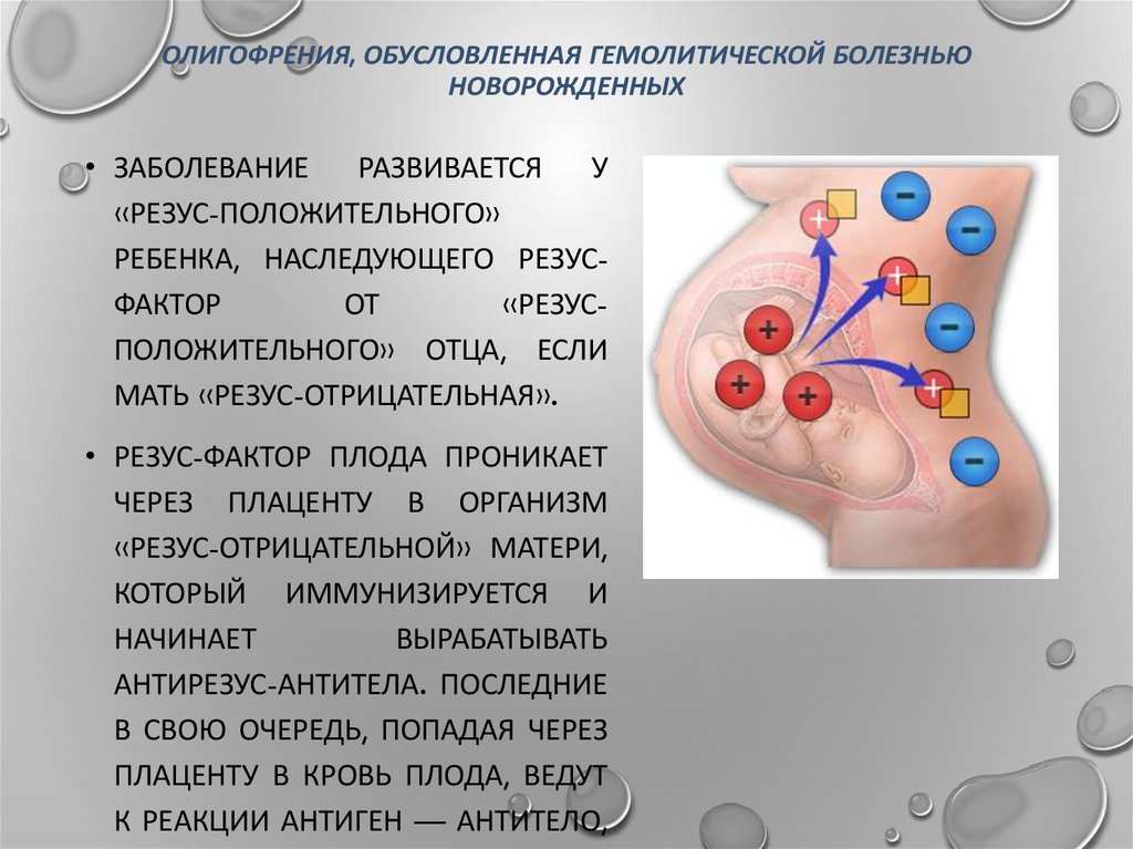 Кровь больной резус. Гемолитическая болезнь резус конфликт. Олигофрения, обусловленная гемолитической болезнью новорожденных. Резус конфликт гемолитическая болезнь новорожденных.