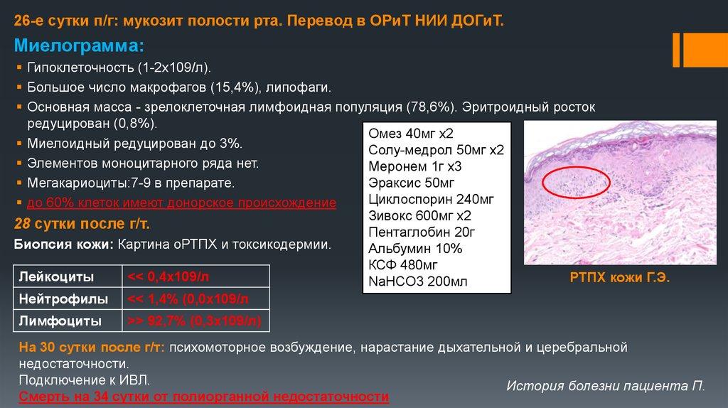 Мукозит после химиотерапии