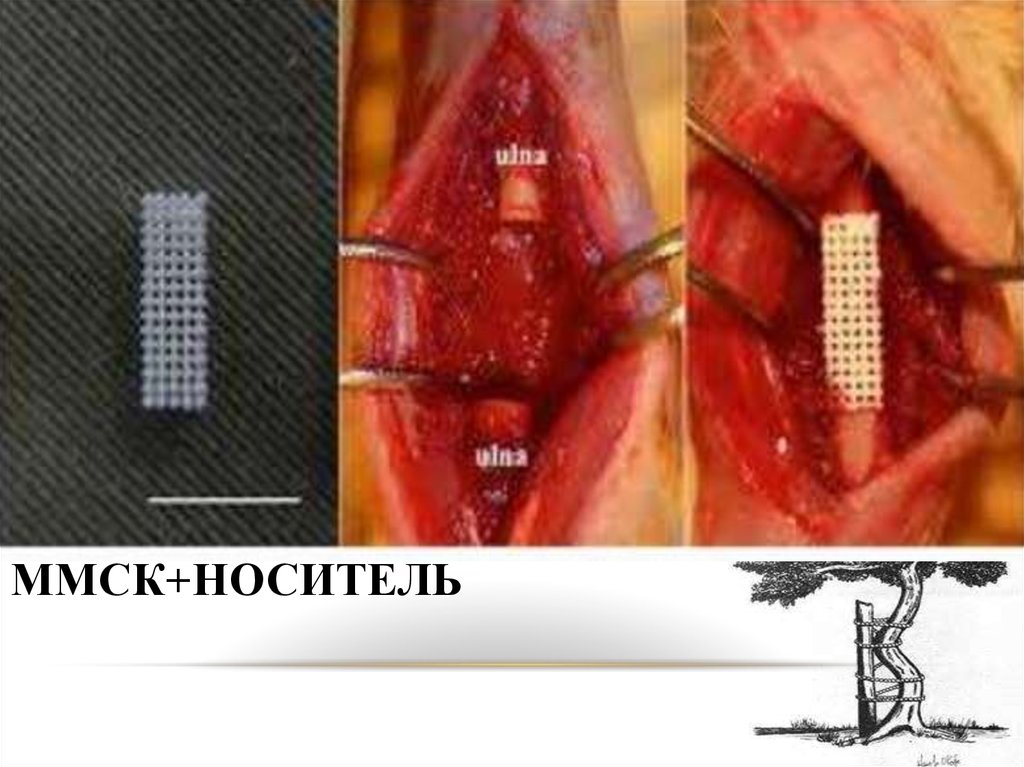 ММСК+носитель