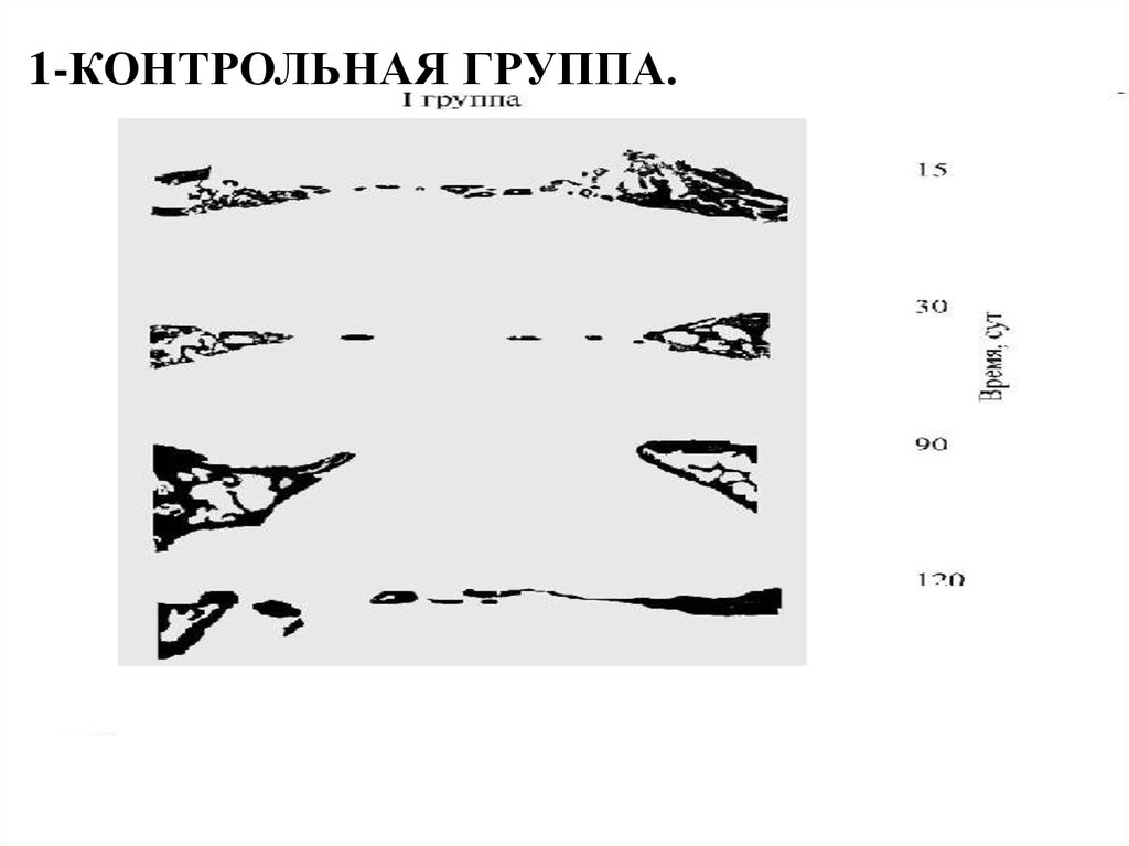 I1-контрольная группа.