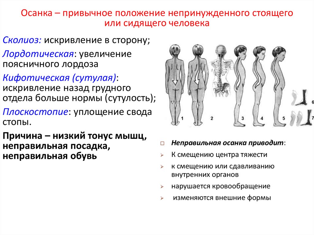 Привычное положение тела стоящего человека. Осанка это привычное положение непринужденно стоящего человека. Уплощение это мышц. Возрастные особенности ОДС. Неправильная осанка может привести к смещению и сдавливанию.