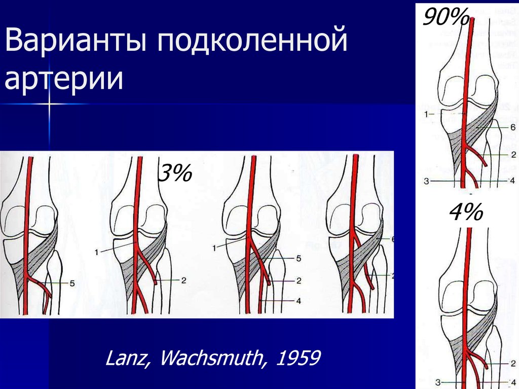 Подколенная артерия. Трифуркация подколенной артерии. Сегменты подколенной артерии. Кровоснабжение подколенной ямки. Конечные ветви подколенной артерии.