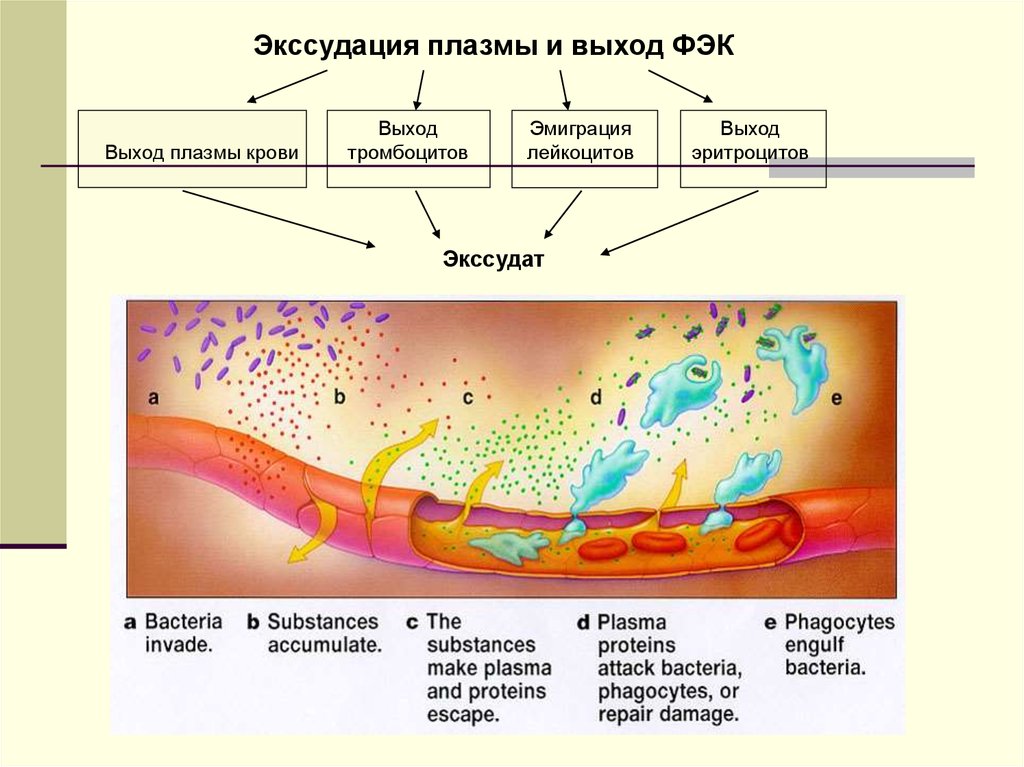 Воспалительная ткань. Экссудация составных частей плазмы крови. Фаза экссудации воспаления. Механизм экссудации при воспалении. Воспаление патофизиология экссудация.