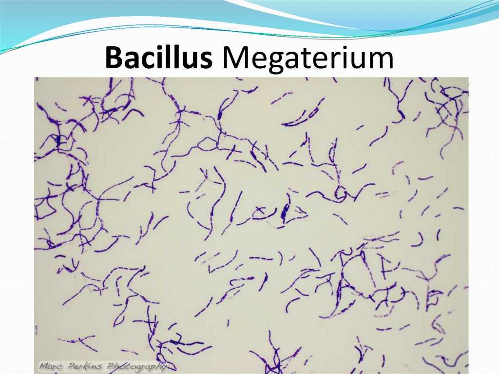 Бацилла это. Бацилла Мегатериум. Bacillus megaterium колонии. Микробиология раздавленная капля Bacillus megaterium. Bacillus megaterium микробиология.