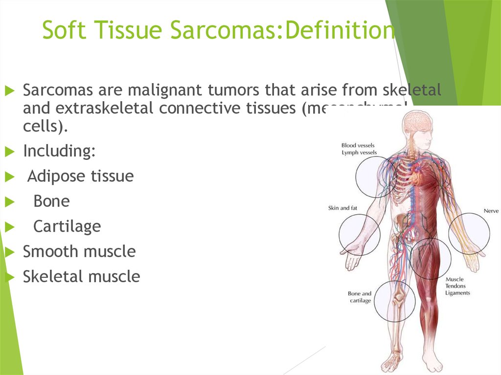 sarcoma cancer definition)