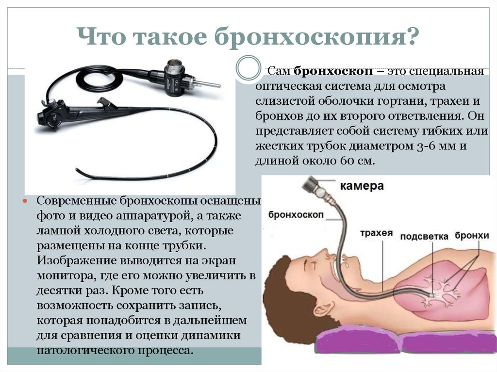 Что лучше бронхоскопия или компьютерная томография легких