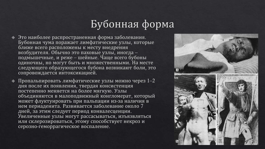 Бубонная форма