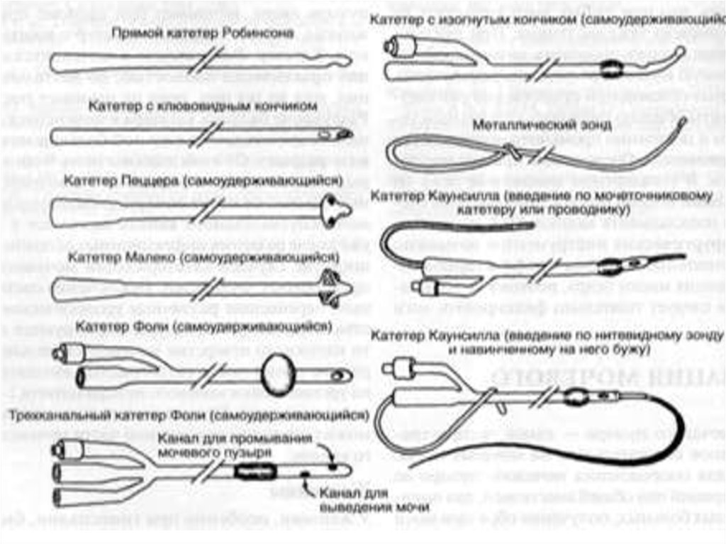 Виды катетеров схема