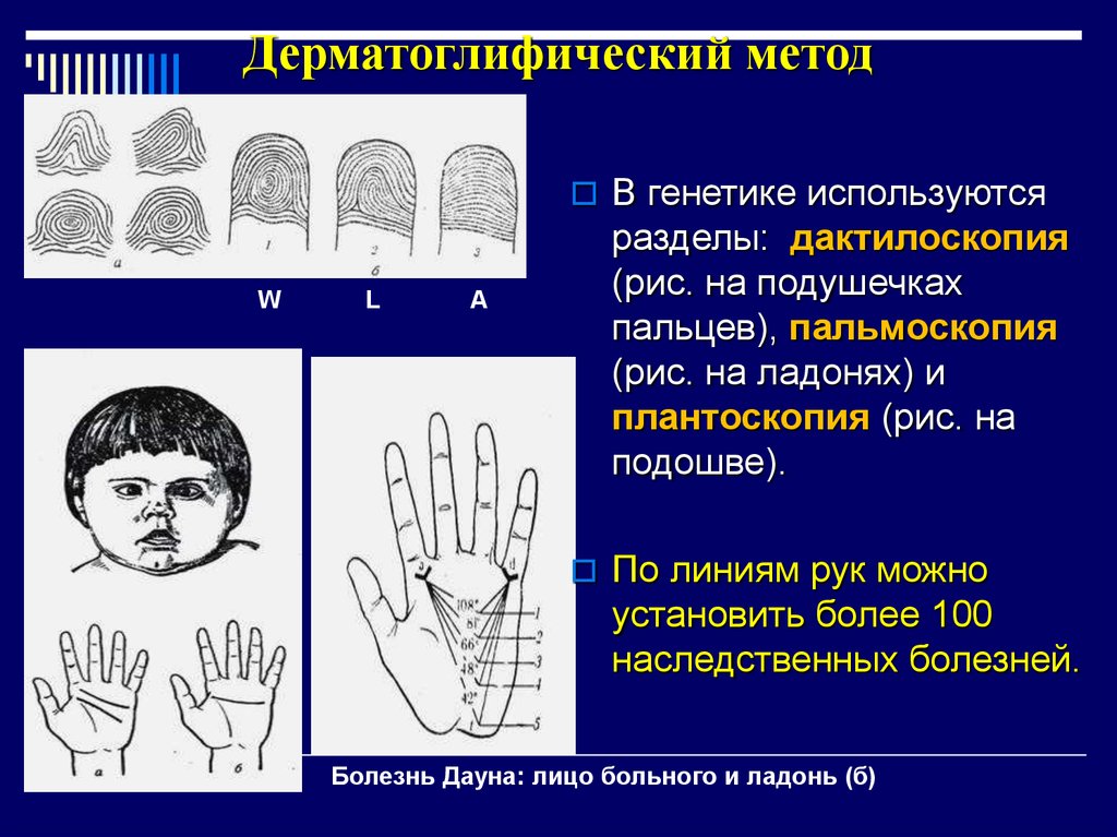 Дерматоглифический метод презентация