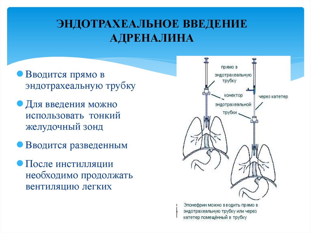 Какие пути введения адреналина не запрещены русада