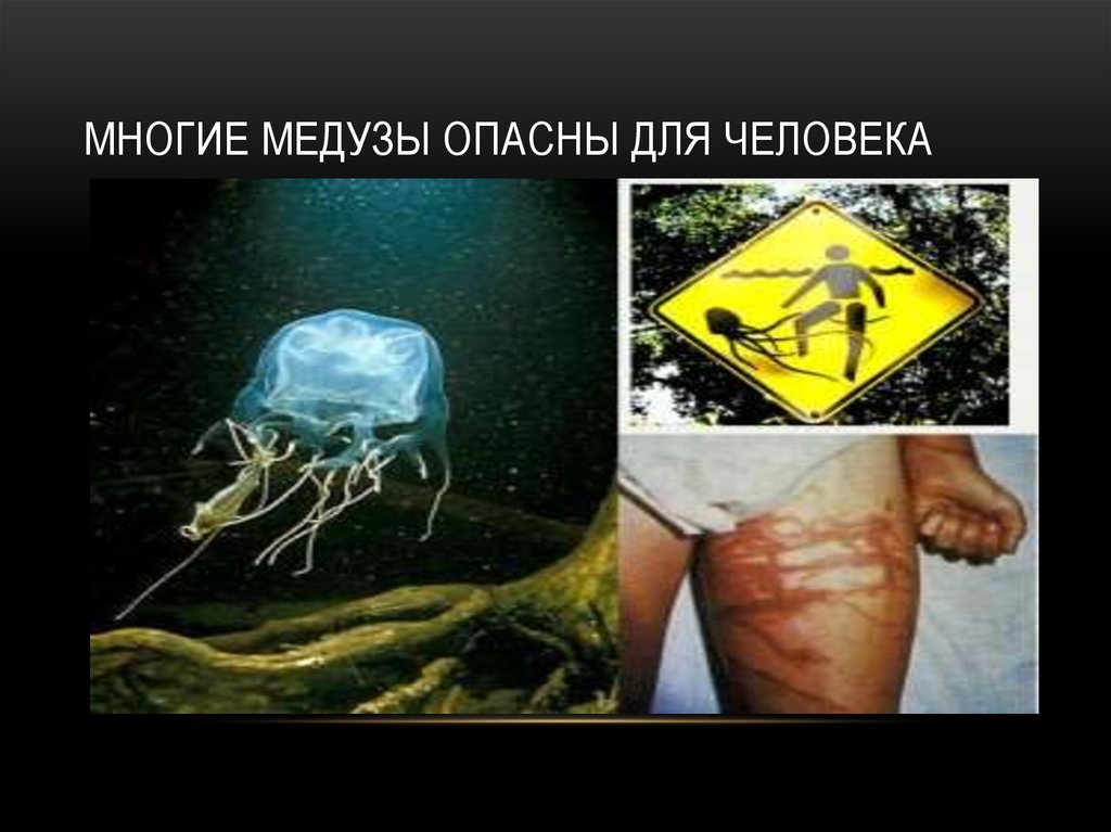 Многие медузы опасны для человека