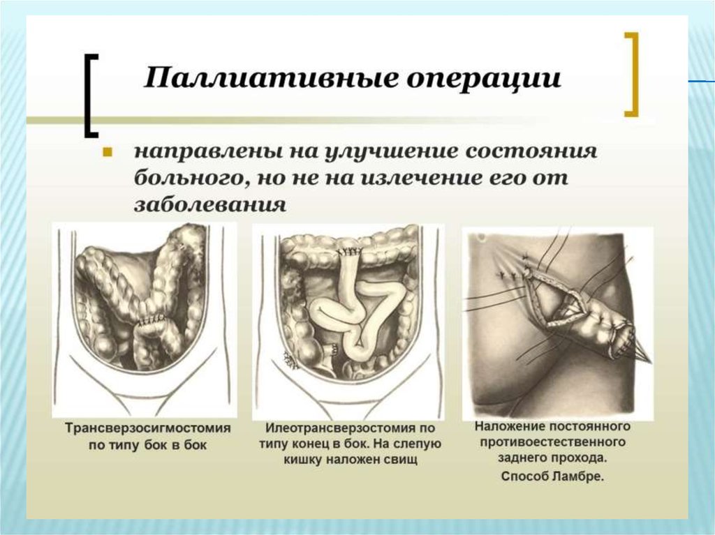 Операция при 1 стадии