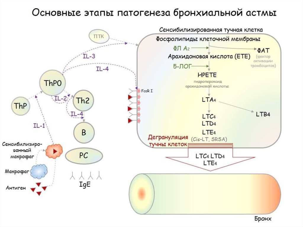 Схема патогенеза бронхиальной астмы