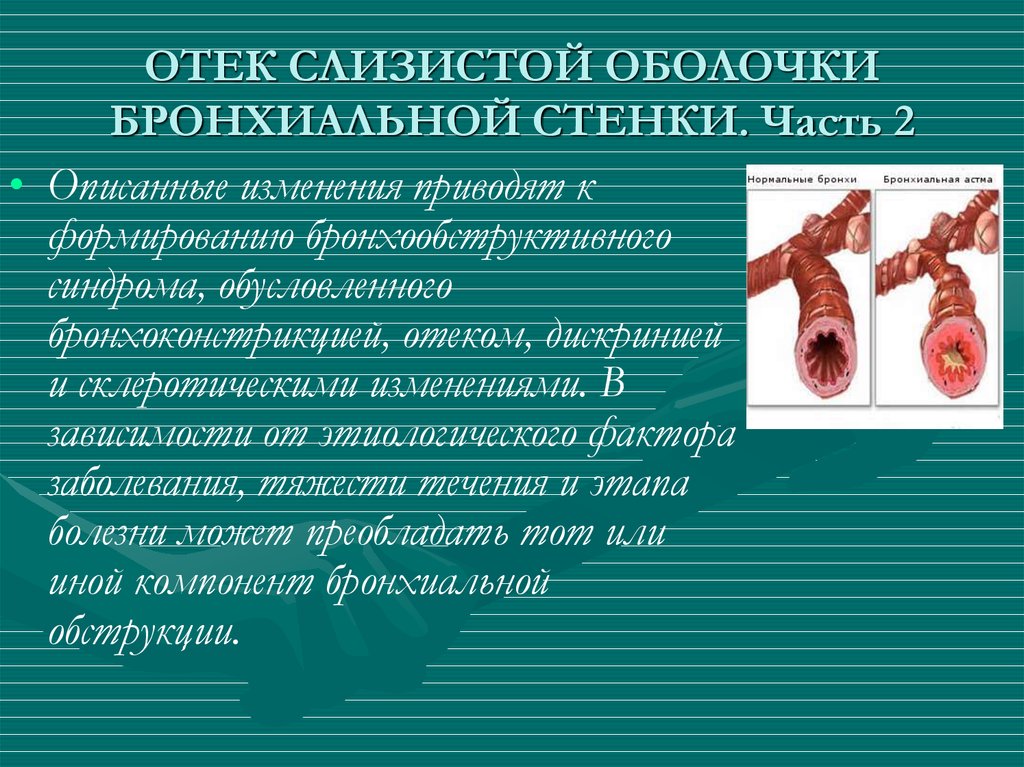 Приводят к формированию. Отек слизистой бронхов. Отек слизистой оболочки бронхов. Отек слизистых бронхов. Бронхиальная стенка.