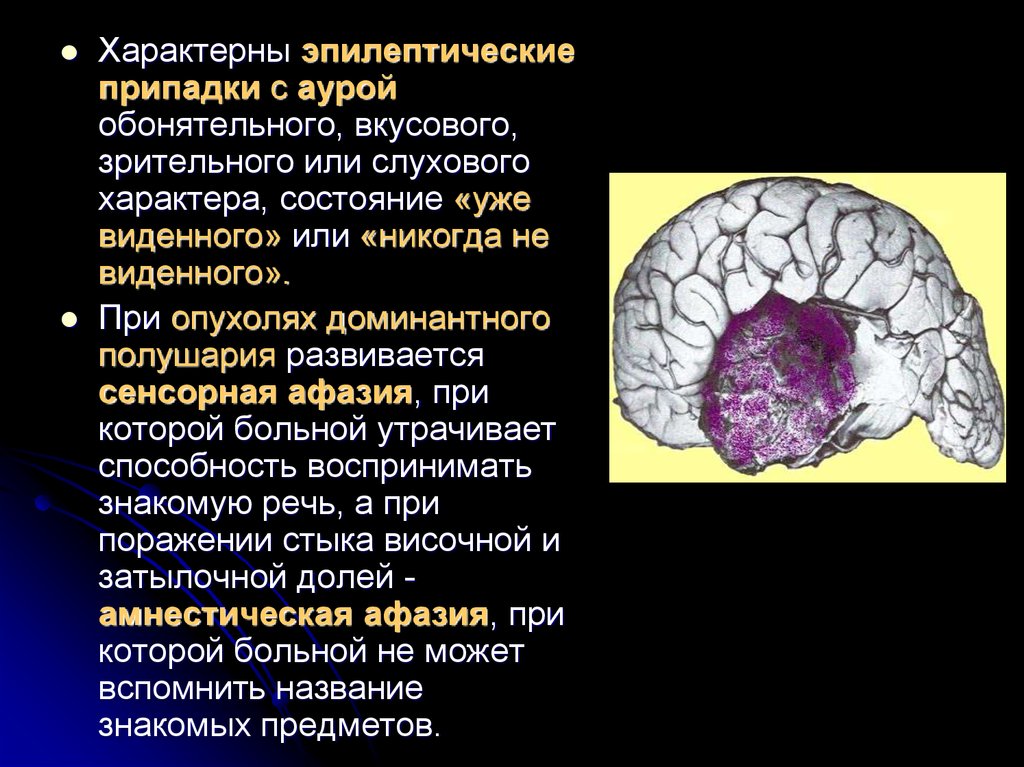 Опухоль головного мозга это. Опухоль затылочной доли. Презентация опухоль мозга. Опухоли височных и затылочных долей.