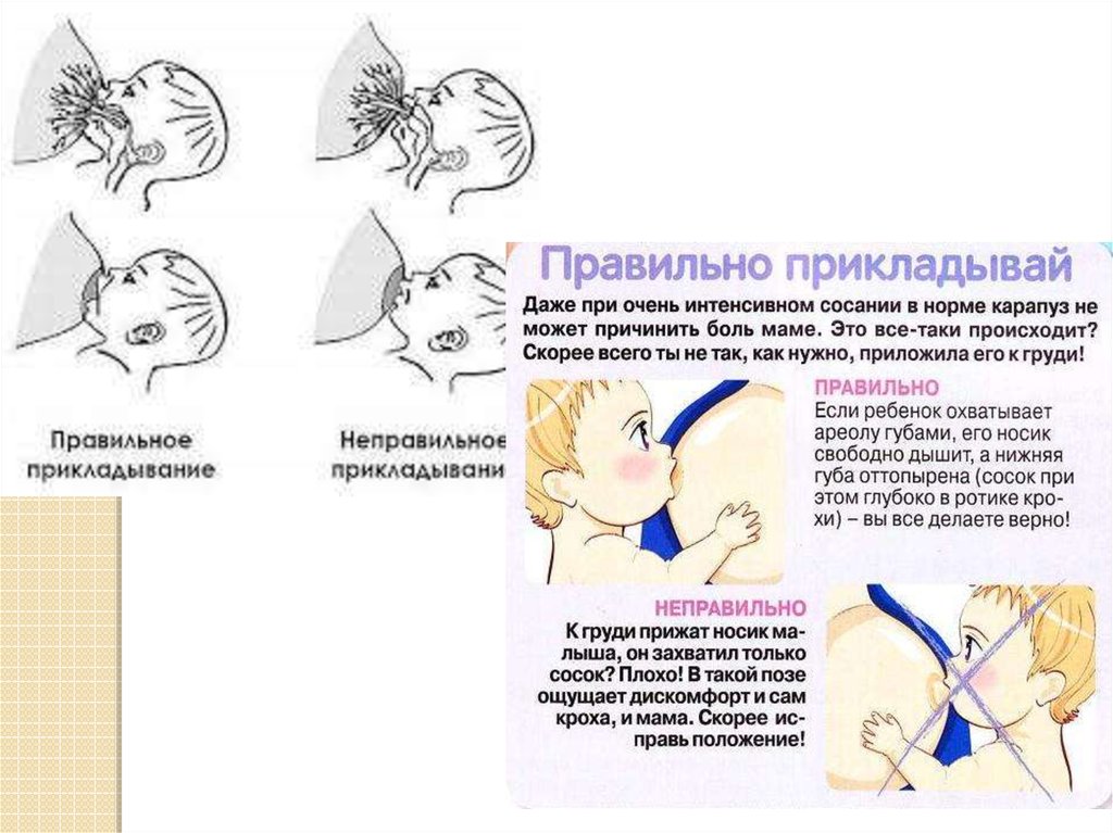 Боль при гв форум. Правильное прикладывание ребенка к груди. Как правильно прикладывать ребенка к груди. Правильный захват груди. Правильное и неправильное прикладывание ребенка к груди.