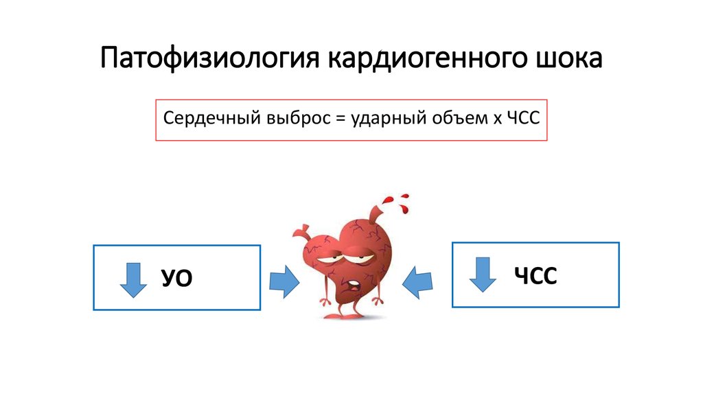 Схема патогенеза кардиогенного шока