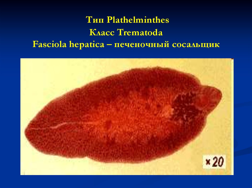 У сосальщиков отсутствует. Fasciola hepatica яйца. Тип plathelminthes класс Trematoda. Трематоды Fasciola hepatica. Фасциола печеночная.