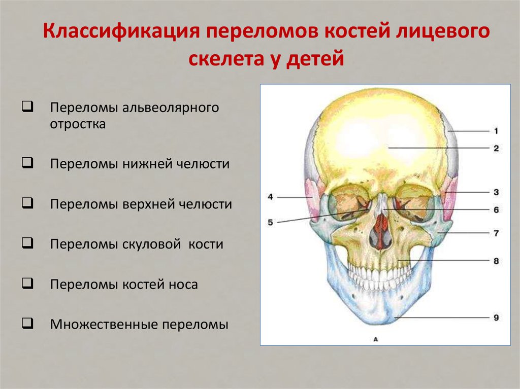 Перелом лицевого черепа. Классификация переломов челюстей лицевого скелета.. Классификация переломов нижней челюсти у детей. Классификация переломов костей лицевого черепа. Перелом костей лицевого черепа.