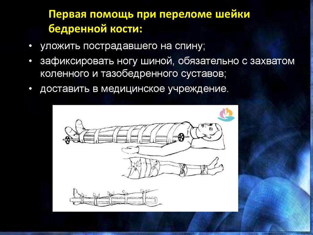 Шейка бедра карта вызова