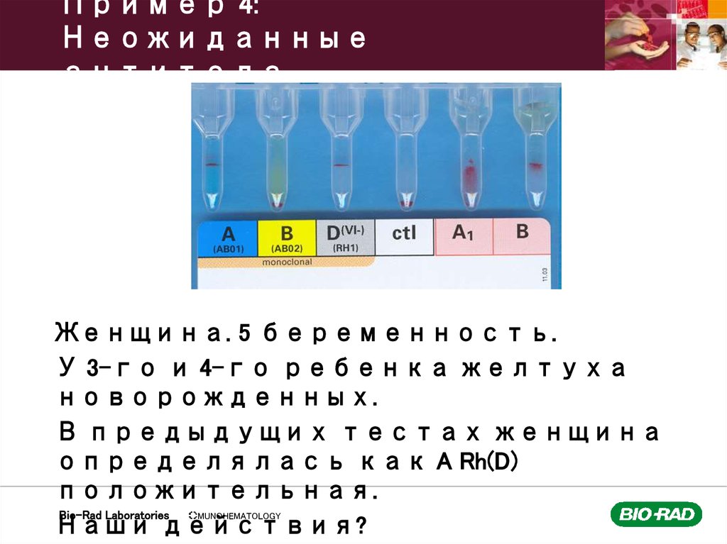 Пример 4: Неожиданные антитела