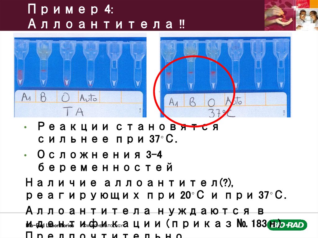Пример 4: Аллоантитела !!