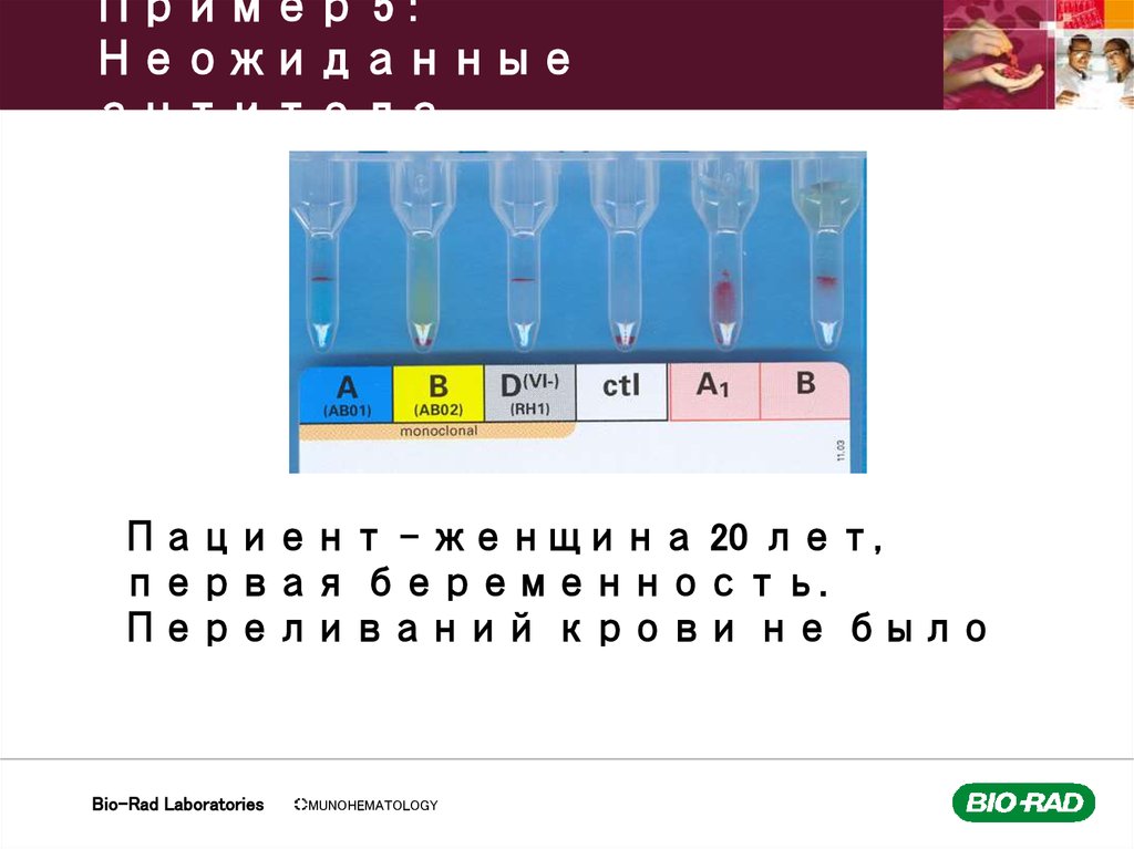 Пример 5 : Неожиданные антитела