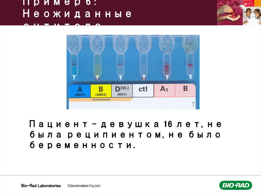 Пример 6 : Неожиданные антитела