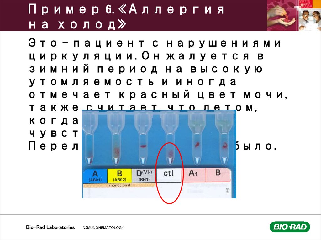 Пример 6. «Аллергия на холод»