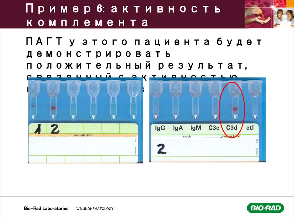 Пример 6: активность комплемента