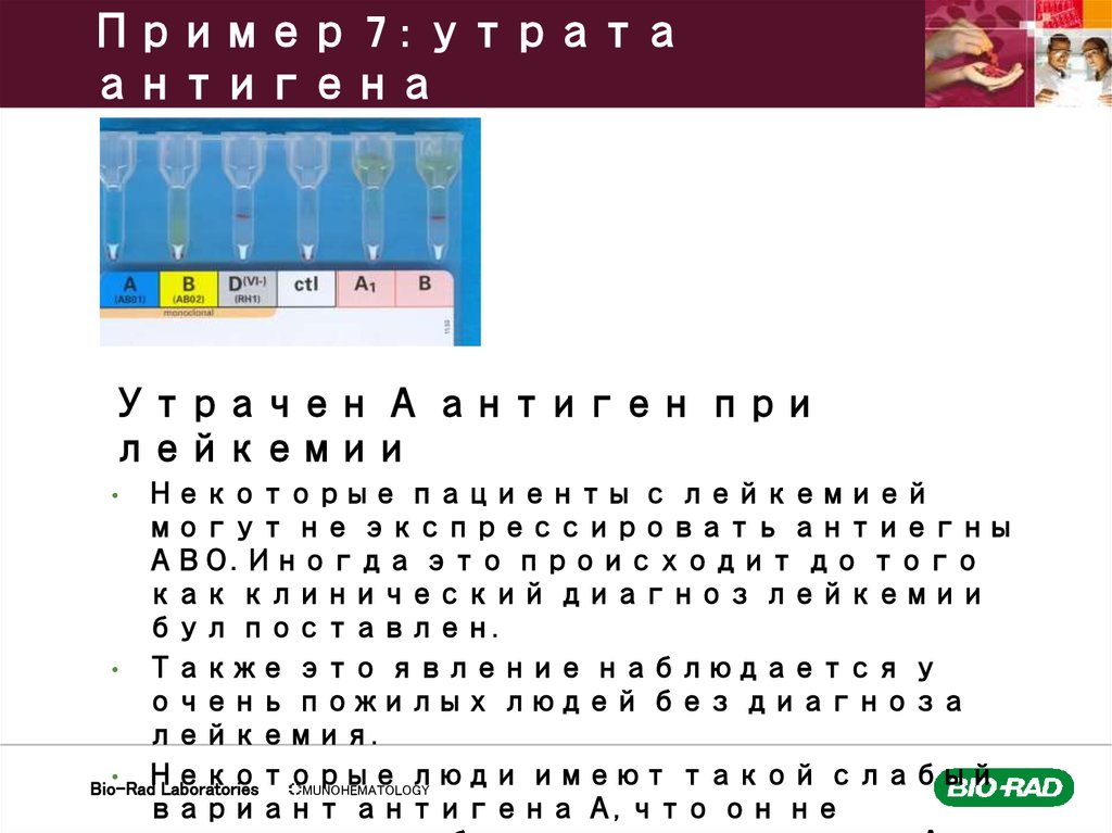 Пример 7 : утрата антигена