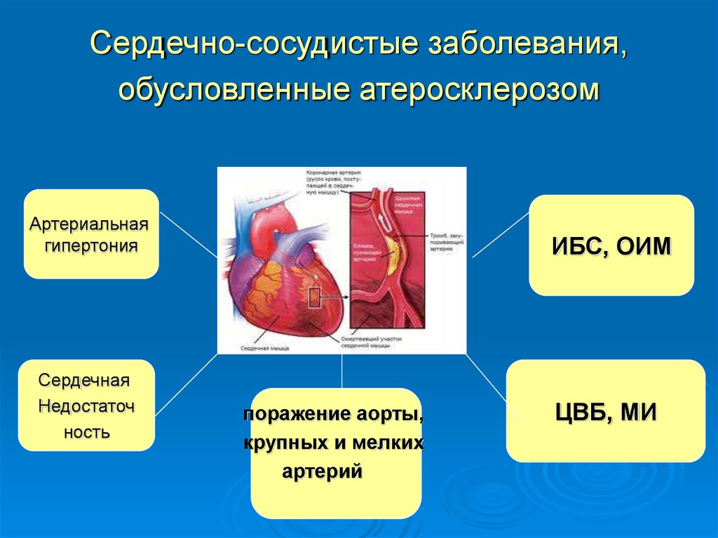 Кровеносные заболевания. Сердечно-сосудистые заболевания. Сосудистыетзаболевания. Сердечно сосудистые болезни.