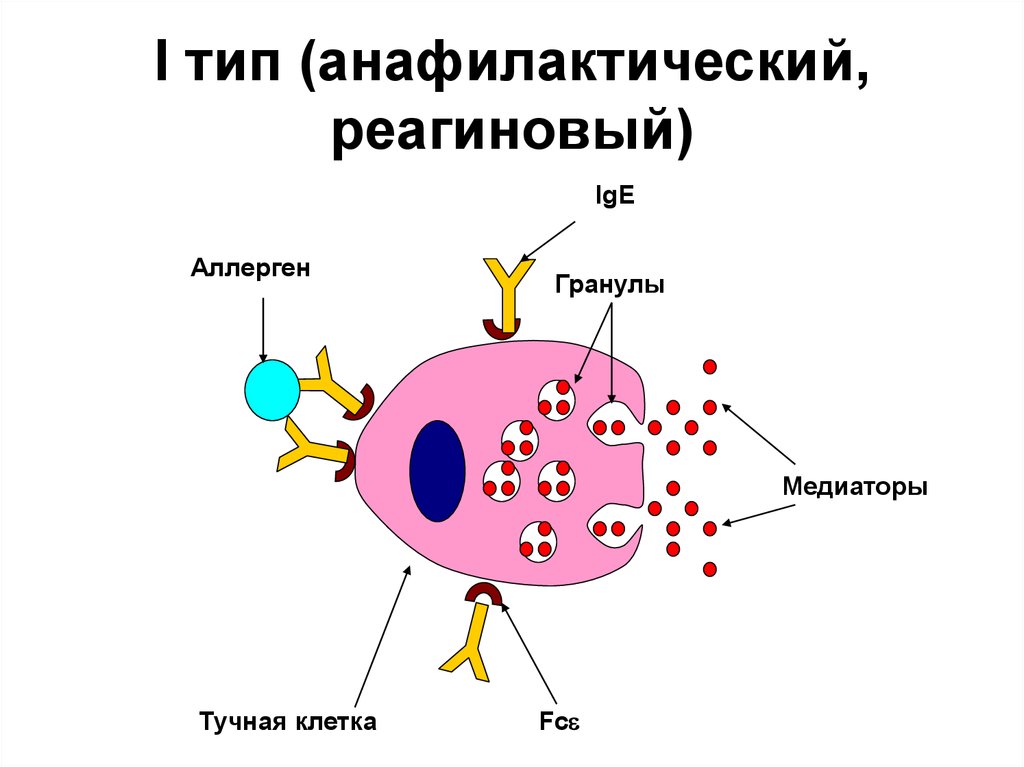 Гиперчувствительность 1 типа схема