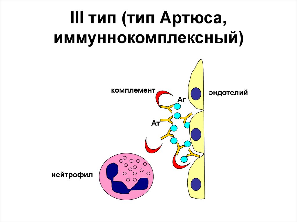 Лизосомальные ферменты. Аллергические реакции третьего типа. Схема аллергической реакции 3 типа. 3 Тип аллергической реакции. Патогенез аллергических реакций 3 типа.
