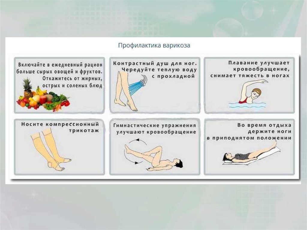 Ноги профилактика. Памятка варикозное расширение вен. Памятка при варикозном расширении вен. Профилактика варикозной болезни вен. Памятка профилактика варикозного расширения вен.