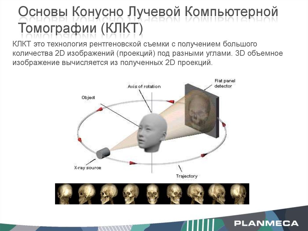 Схема получения изображения кт