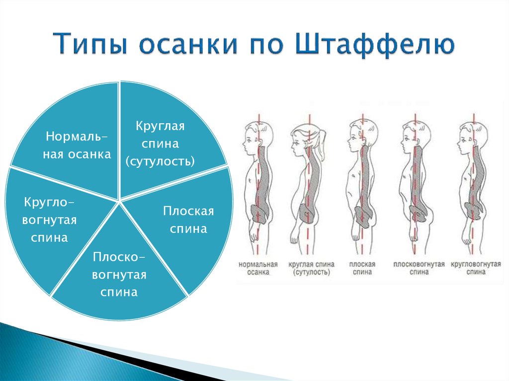 4 основных типа. Нарушения осанки классификация по штаффелю. Типы осанки по штаффелю характеристика. Типы осанок по ф. штаффелю. Типы осанки человека по штаффелю.