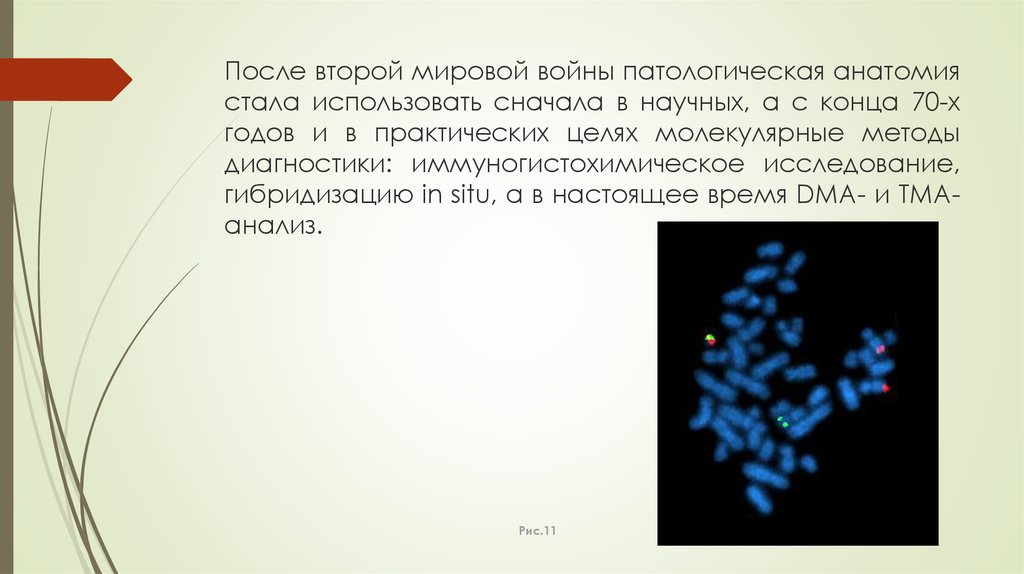 История развития патологической анатомии презентация