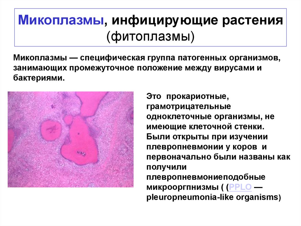 Микоплазменная этиология. Микоплазмы строение микробиология. Микоплазмы характеризуются. Микоплазменные болезни растений. Микоплазмы возбудители.