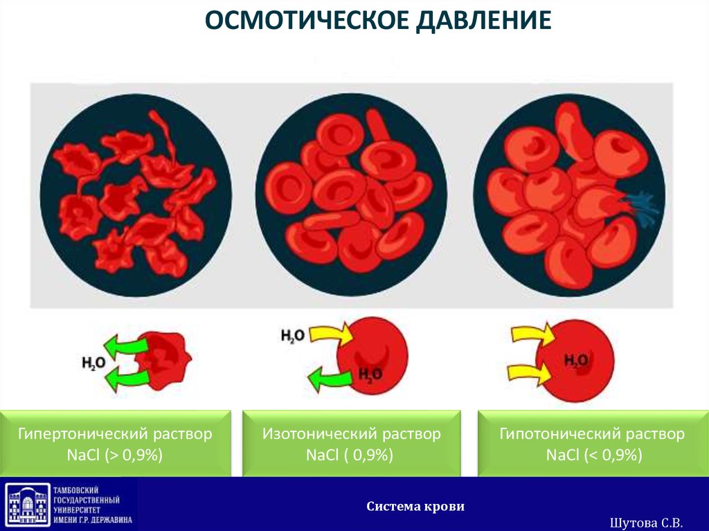 Эритроциты в растворе хлорида натрия. Осмотическое явление клеток крови. Осмотическое давление крови.