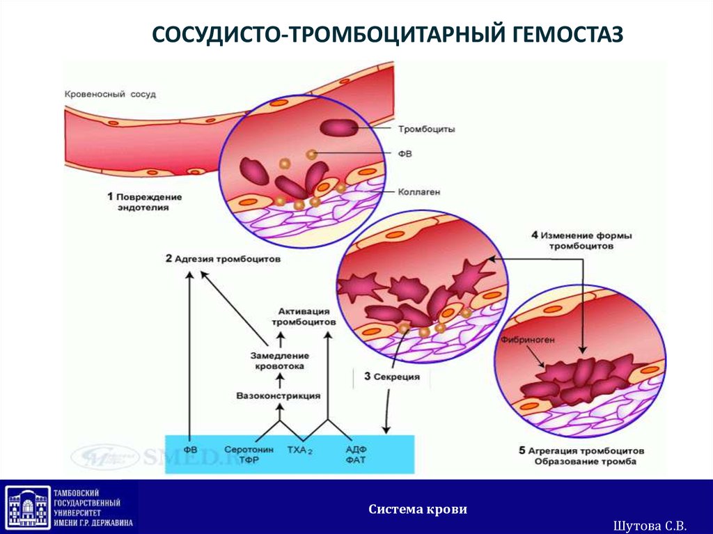 Тромб норма. Схема «механизмы гемостаза сосудисто тромбоцитарный. Сосудисто-тромбоцитарный (микроциркуляторный) гемостаз. 2 Стадия сосудисто тромбоцитарного гемостаза. Схема тромбоцитарного и коагуляционного гемостаза.