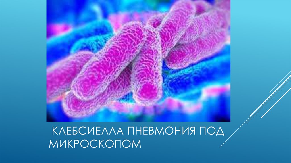 Клебсиелла пневмония под микроскопом